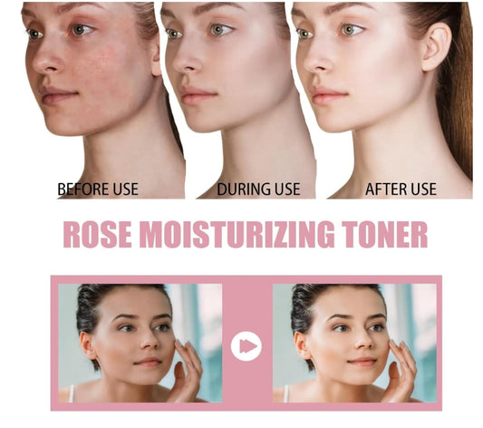 Rose Hydrating Toner - By Beautilla